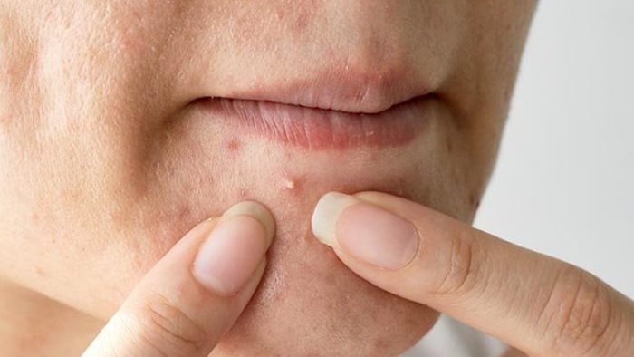 Bu Belirtiler Vücudunuzdaki Vitamin Eksikliğinin Habercisi