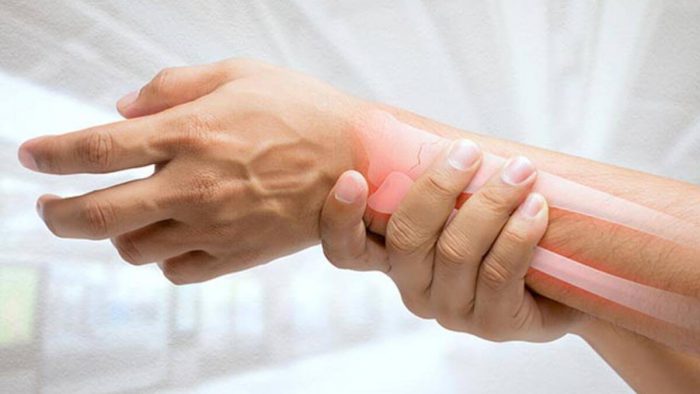 Kemik Erimesi (Osteoporoz) Belirtileri