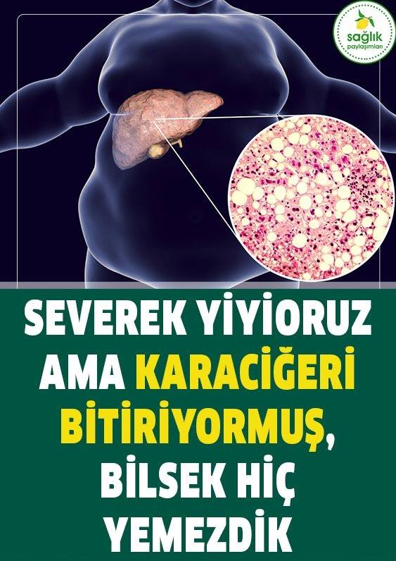 Severek Yiyoruz Ama Karaciğeri Bitiriyoruz